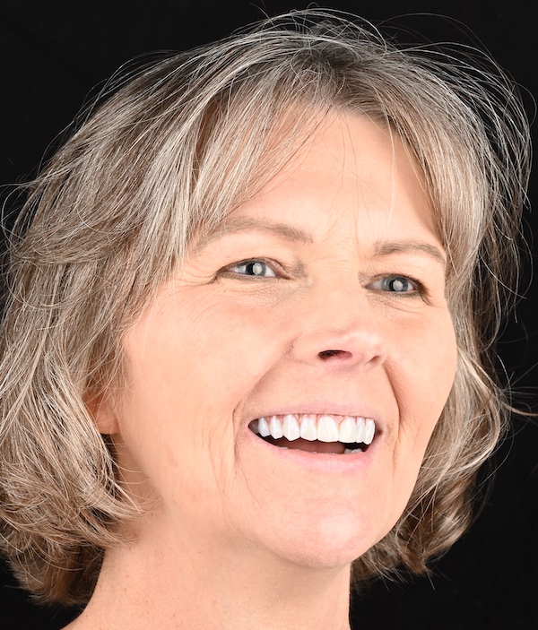 Carletta Full Face after