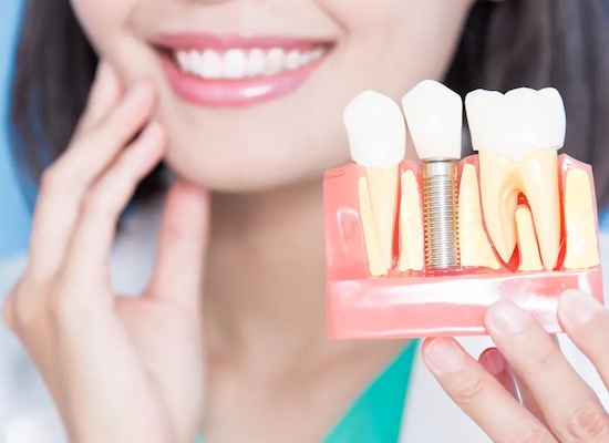 Are Dental Implants Painful?