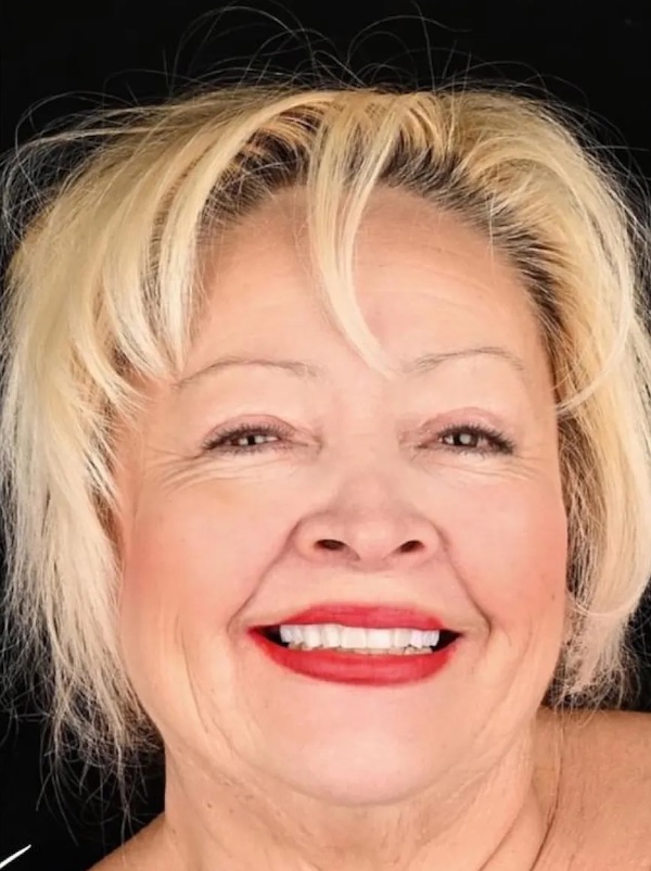 Leticia Full Face before