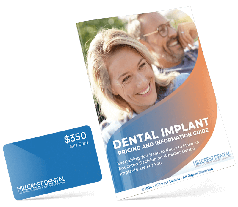 Dental Implants guide