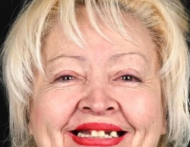 Leticia Full Face Before