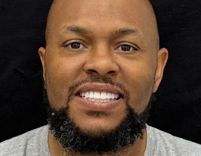 Ronique Full Face After