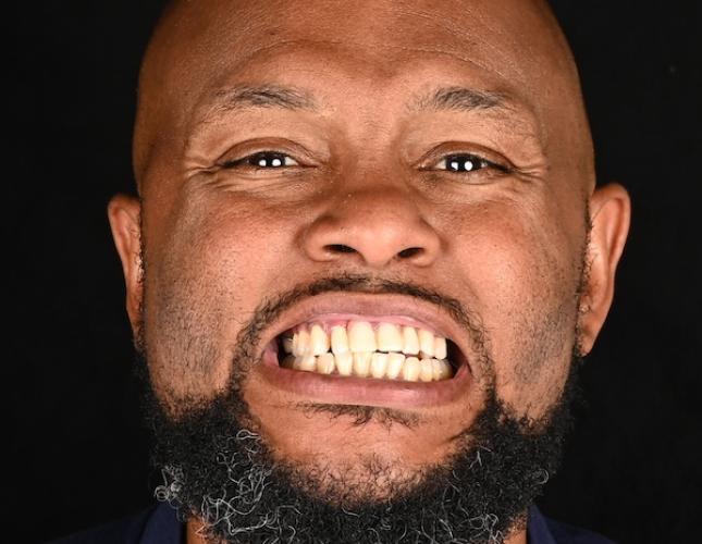 Ronique Full Face Before